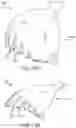 Fig. 32 - Left atrial appendage treatment systems and methods