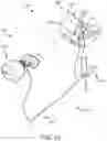 Fig. 34 - Left atrial appendage treatment systems and methods