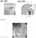 Fig. 08 - ANCHOR DEVICE