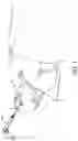 Fig. 02 - Non-rotational bone cutting tools and related systems and methods