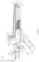 Fig. 03 - Coracoid drill guide assembly and methods of use thereof