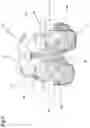 Fig. 07 - Patient-specific guide for total prosthetic knee revision