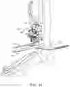 Fig. 23 - Alignment instruments and methods for use in total ankle replacement