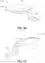 Fig. 41 - Alignment instruments and methods for use in total ankle replacement
