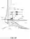 Fig. 44 - Alignment instruments and methods for use in total ankle replacement