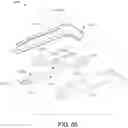 Fig. 47 - Alignment instruments and methods for use in total ankle replacement