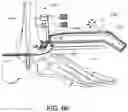 Fig. 48 - Alignment instruments and methods for use in total ankle replacement