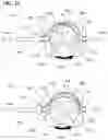 Fig. 11 - Aspiration systems, devices and methods for treating ischemic stroke