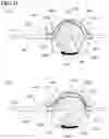 Fig. 10 - Aspiration systems, devices and methods for treating ischemic stroke