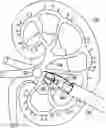 Fig. 01 - DILATION AND STONE RETRIEVAL CATHETER