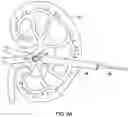 Fig. 11 - DILATION AND STONE RETRIEVAL CATHETER