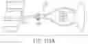 Fig. 51 - ULTRASONIC AND ELECTROSURGICAL DEVICES
