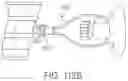 Fig. 52 - ULTRASONIC AND ELECTROSURGICAL DEVICES