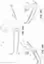 Fig. 16 - MEDICAL TOOLS FOR AND METHODS OF GAINING ACCESS TO EXTRAVASCULAR SPACES