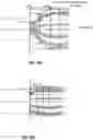Fig. 16 - SYSTEMS, APPARATUSES, AND METHODS FOR REMOVING A MEDICAL IMPLANT FROM CARDIAC TISSUE