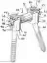 Fig. 01 - DYNAMIC SPINAL STABILIZATION WITH ROD-CORD LONGITUDINAL CONNECTING MEMBERS