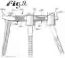 Fig. 05 - DYNAMIC SPINAL STABILIZATION WITH ROD-CORD LONGITUDINAL CONNECTING MEMBERS