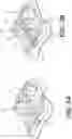 Fig. 04 - Anterior cervical plate assembly