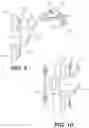 Fig. 07 - Expandable spinal fixation system