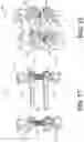 Fig. 14 - Expandable spinal fixation system