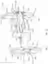 Fig. 18 - Expandable spinal fixation system