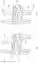 Fig. 24 - Expandable spinal fixation system