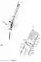 Fig. 02 - Connection device for use with extension members of a bone anchor