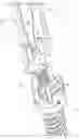 Fig. 01 - Bone anchor, instruments, and methods for use