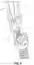 Fig. 10 - Bone anchor, instruments, and methods for use