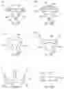 Fig. 18 - Methods and devices for intracorporeal bonding of implants with thermal energy