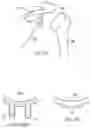 Fig. 32 - Methods and devices for intracorporeal bonding of implants with thermal energy