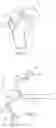 Fig. 33 - Methods and devices for intracorporeal bonding of implants with thermal energy