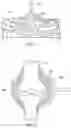 Fig. 34 - Methods and devices for intracorporeal bonding of implants with thermal energy