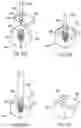 Fig. 41 - Methods and devices for intracorporeal bonding of implants with thermal energy