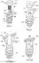 Fig. 43 - Methods and devices for intracorporeal bonding of implants with thermal energy
