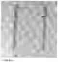 Fig. 55 - Methods and devices for intracorporeal bonding of implants with thermal energy