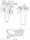 Fig. 62 - Methods and devices for intracorporeal bonding of implants with thermal energy