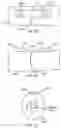 Fig. 70 - Methods and devices for intracorporeal bonding of implants with thermal energy