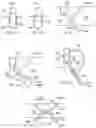 Fig. 76 - Methods and devices for intracorporeal bonding of implants with thermal energy