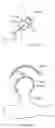 Fig. 83 - Methods and devices for intracorporeal bonding of implants with thermal energy