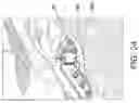 Fig. 20 - Tibial plateau leveling osteotomy plate