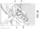 Fig. 21 - Tibial plateau leveling osteotomy plate