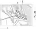 Fig. 22 - Tibial plateau leveling osteotomy plate