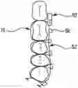 Fig. 01 - Maxillomandibular fixation device