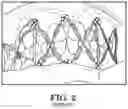 Fig. 03 - Maxillomandibular fixation device