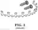 Fig. 04 - Maxillomandibular fixation device
