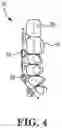 Fig. 05 - Maxillomandibular fixation device