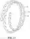 Fig. 11 - Maxillomandibular fixation device