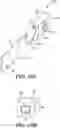 Fig. 16 - Maxillomandibular fixation device