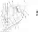 Fig. 16 - TISSUE VISUALIZATION AND MODIFICATION DEVICES AND METHODS